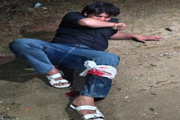 गाजियाबाद पुलिस ने मुठभेड़ में शातिर बदमाश को किया गिरफ्तार, पैर में लगी गोली